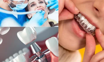 Düzce İmplant Uzman Kadro ve Deneyim Avantajları