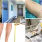 Bacak Uzatma Ameliyatı - Leg Extension Surgery