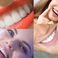 Türkiye’de Hollywood Gülüşü - Hollywood Smile in Turkey Uygulaması Var Mıdır?